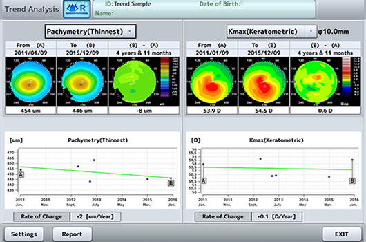 Cornea Trend Analysis